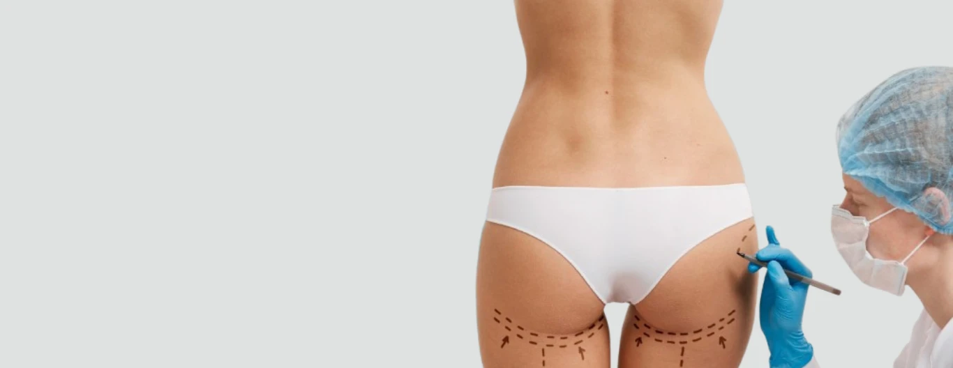 Brazilian Butt Lift: What to Expect Before, During and After Treatment