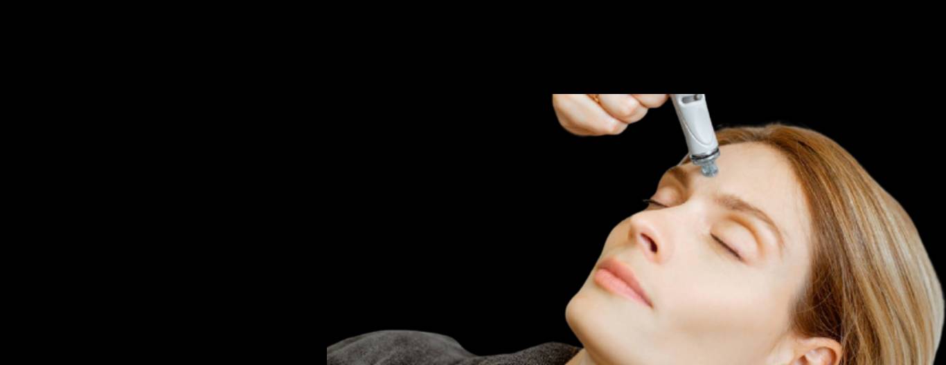 Forehead Reconstruction Type 1 & 3