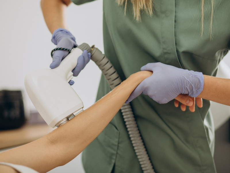 Laser Hair Removal