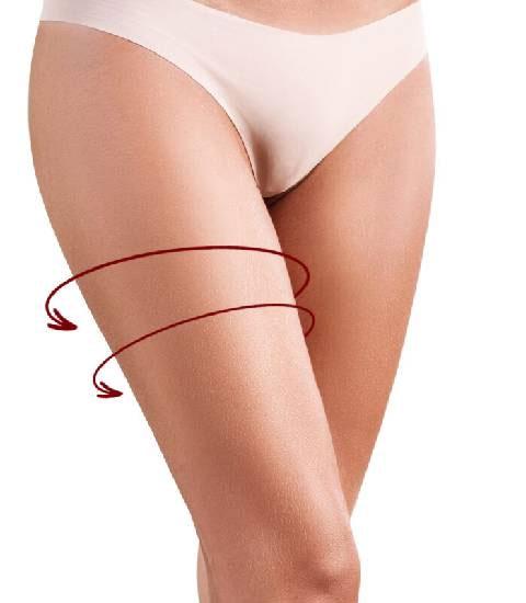 Types of Thigh Lift Procedures