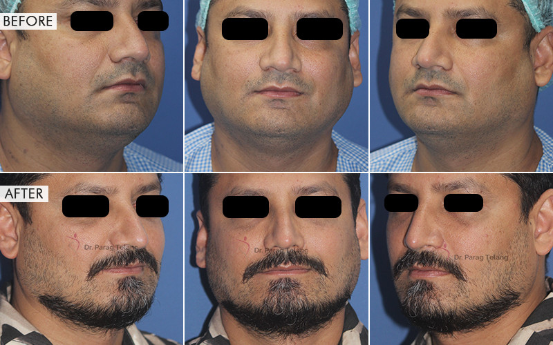 Facial Aesthetics Surgery