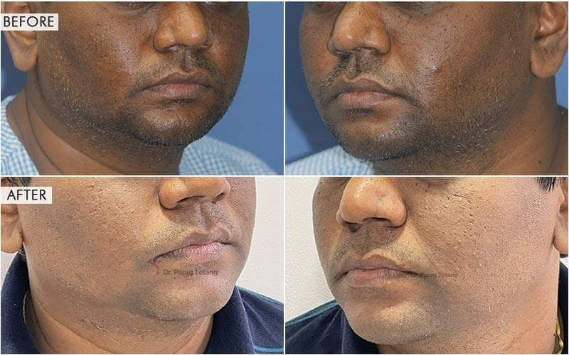 Facial Aesthetics Surgery