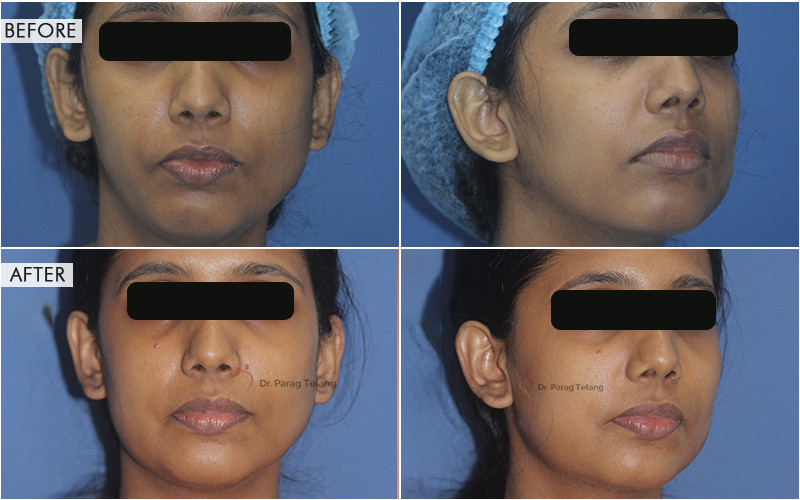 Facial Aesthetics Surgery