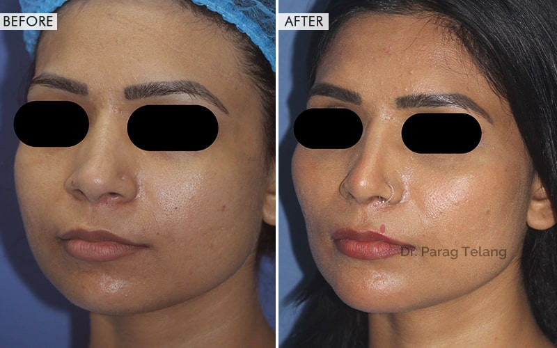Facial Aesthetics Surgery