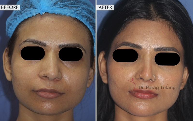 Facial Aesthetics Surgery