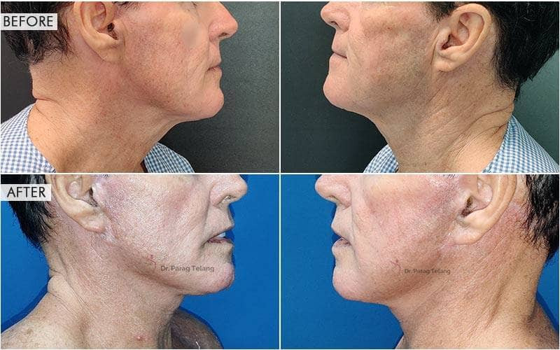 Facial Aesthetics Surgery