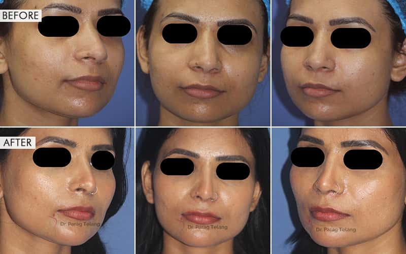 Facial Aesthetics Surgery