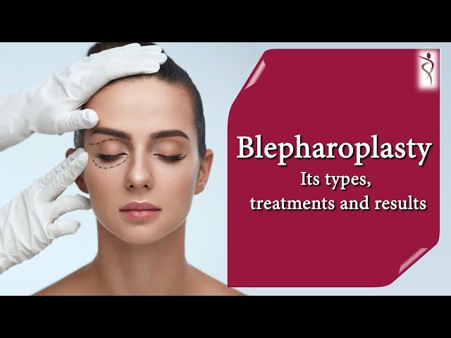 Blepharoplasty