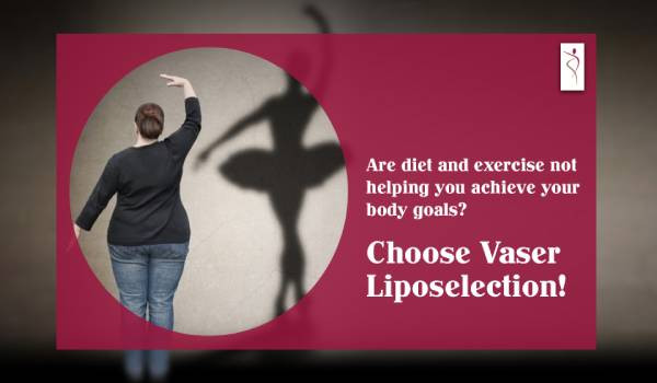Vaser Liposuction