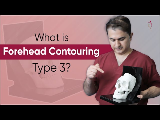 Forehead Reconstruction