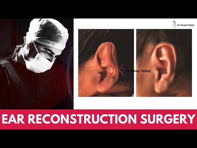 Ear Reconstruction Surgery