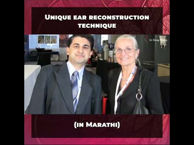 Unique Ear Reconstruction